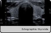 Echographie thyroïdienne, écho qualité, cabinet échographie